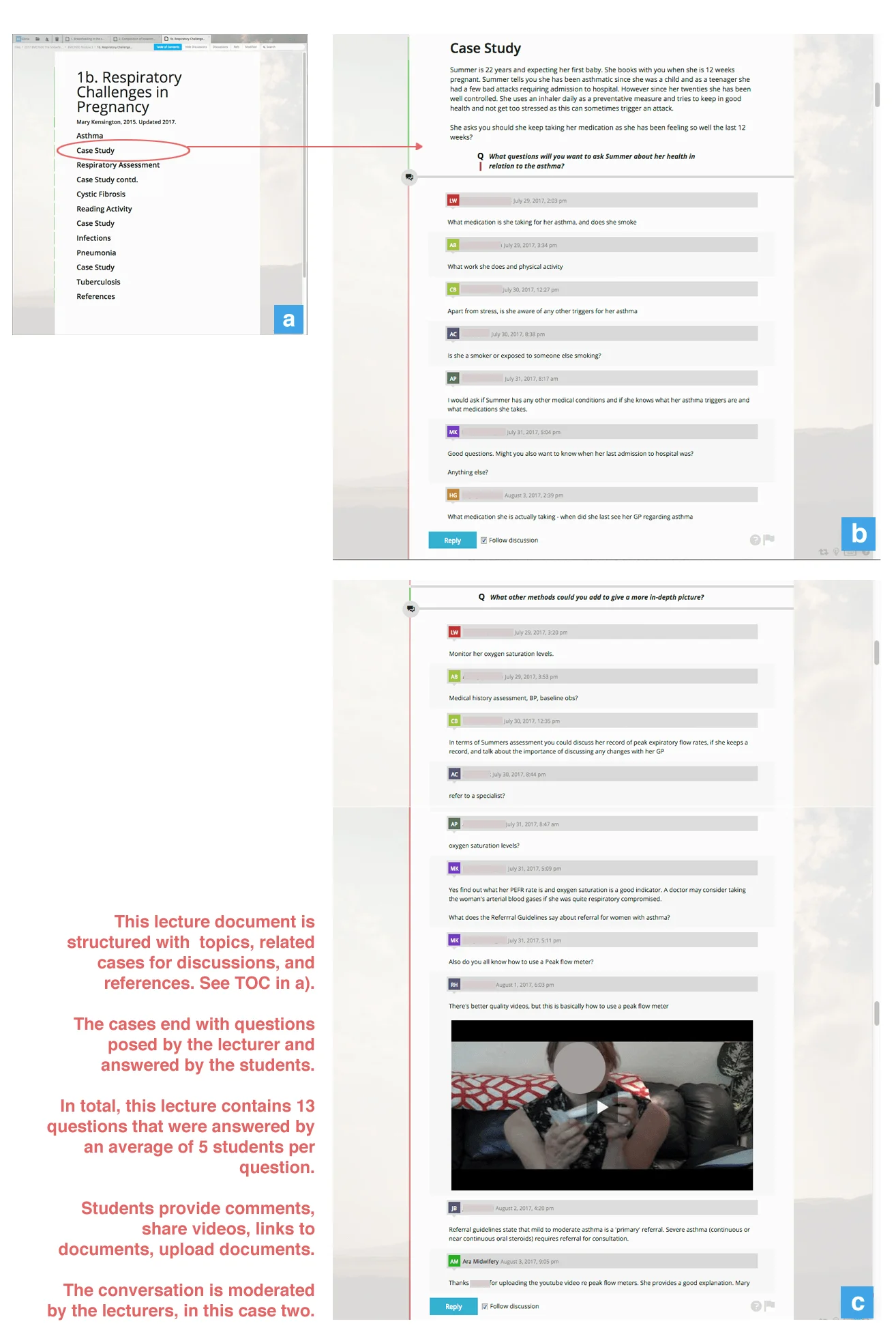 Figure soured from Gomez et al. published in 2017. It illustrates section of a curriculum content document built in ob3. The title is Respiratory challenges in pregnancy.  The section highlighted is the Q&A. The student answers are done using the embedded discussions. Most answers are in text form but one includes a video.  
