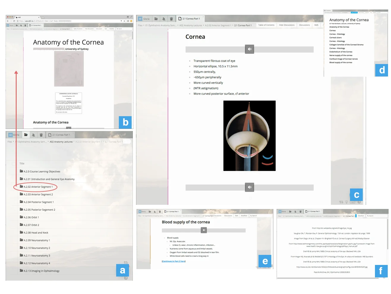 Figure sourced from Gomez et al. 2017. It presents sections of a lecture document on an ophthalmology paper in anatomy. The title is Anatomy of the cornea. The figure is created with screenshots of 6 sections of the documents, highilighting features.